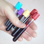 hand-holding-blood-test-bottles