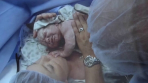 baby-on-woman-chest-in-theatre-after-caesarean-birth